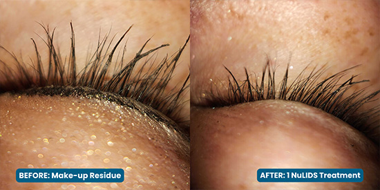 Eye Associates of New York | Neurolens, Myopia Management and Emergency Service