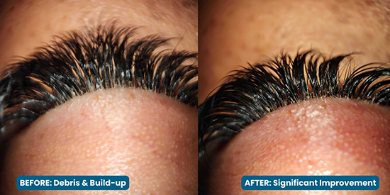 Eye Associates of New York | Computer Vision, Specialty Contact Lenses and LASIK Evaluations